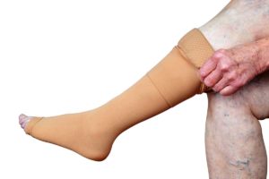 compression stockings for post thrombotic syndrome