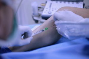 treating spider veins and varicose veins - ultrasound guided sclerotherapy