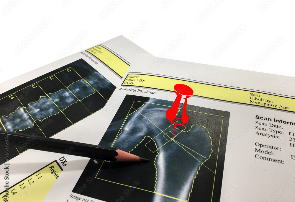 AdobeStock_292920768_Preview