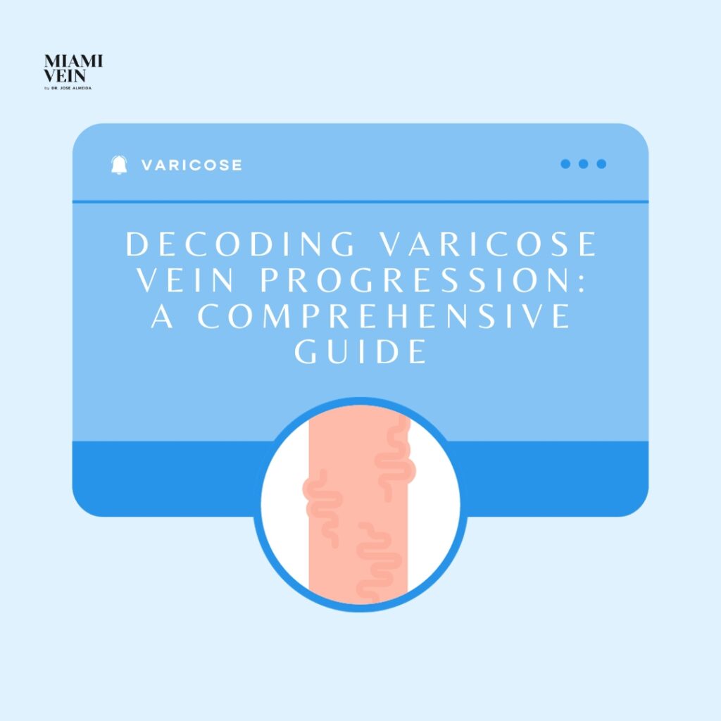 Understanding The 3 Stages of Vein Disease Progression - Miami Vein Center